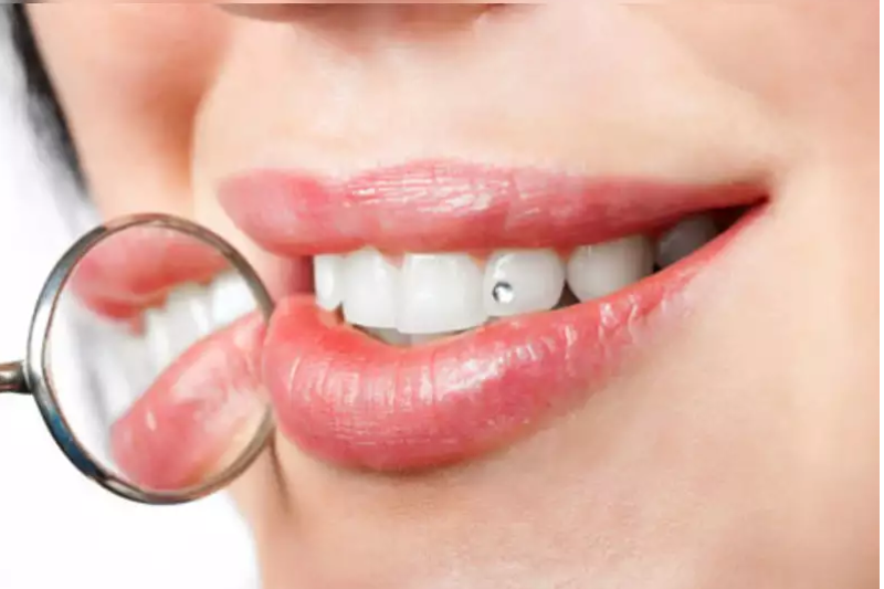 TOOTH JEWELLERY