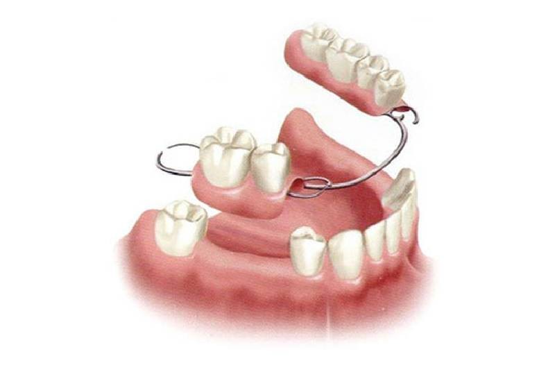 COMPLETE FIXED & REMOVABLE PROSTHESIS