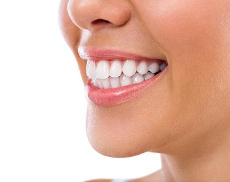 FULL MOUTH REHABILITATION