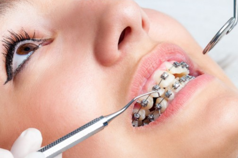 Best Dental Care Clinic in Nehru Nagar Ghaziabad